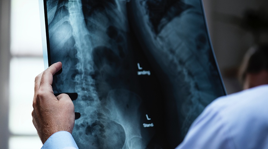 Chiropractor looking at an x-ray of a patient's spine